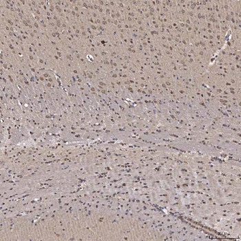 NOB1 Rabbit Polyclonal Antibody