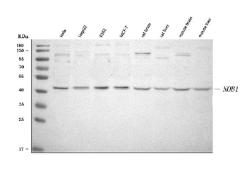 NOB1 Rabbit Polyclonal Antibody