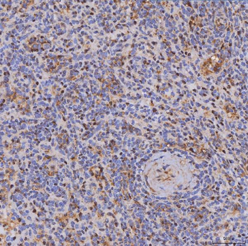 ITK Rabbit Polyclonal Antibody