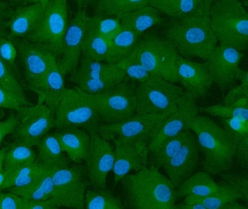 INF2 Rabbit Polyclonal Antibody