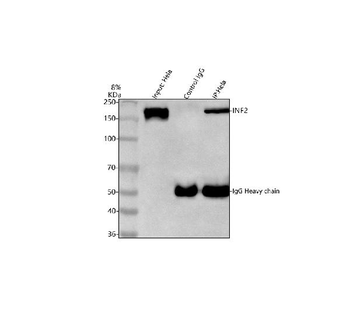 INF2 Rabbit Polyclonal Antibody