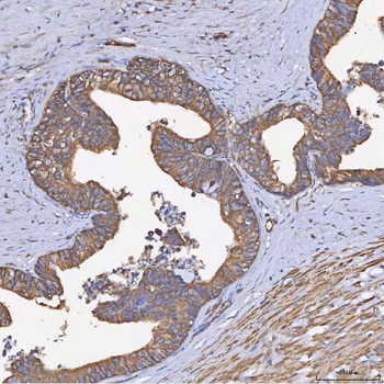 HSD11B2 Rabbit Polyclonal Antibody