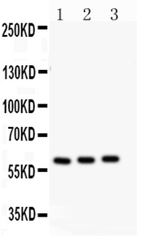 CYP11A1 Rabbit Polyclonal Antibody