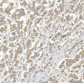 TXNDC5 Antibody