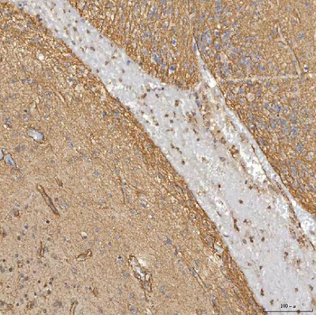 Sm-D3/SNRPD3/D3 Rabbit Polyclonal Antibody
