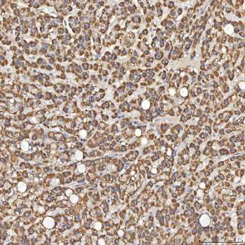 Sm-D3/SNRPD3/D3 Rabbit Polyclonal Antibody