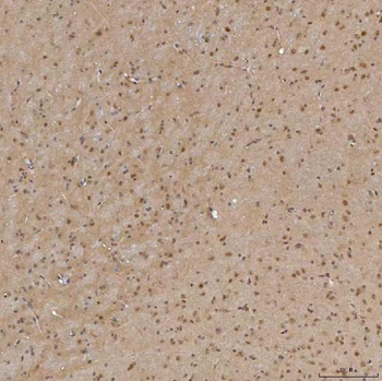 Sm-D3/SNRPD3/D3 Rabbit Polyclonal Antibody