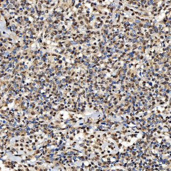 SNRPD2 Antibody
