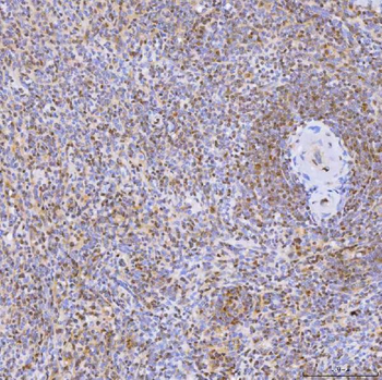 U1-C/SNRPC Antibody