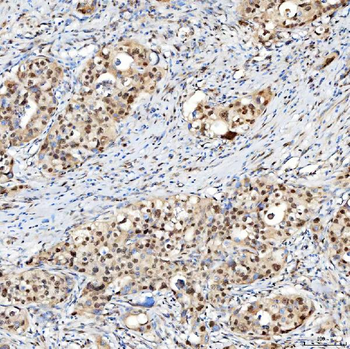 U1-C/SNRPC Antibody