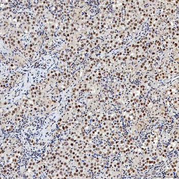 SNRNP200 Antibody