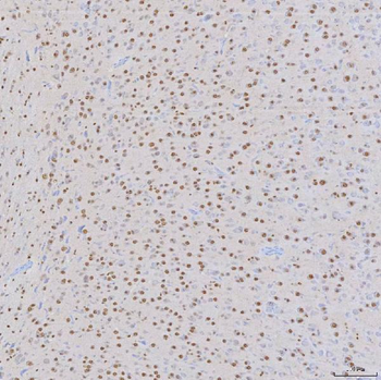 SNRNP200 Antibody