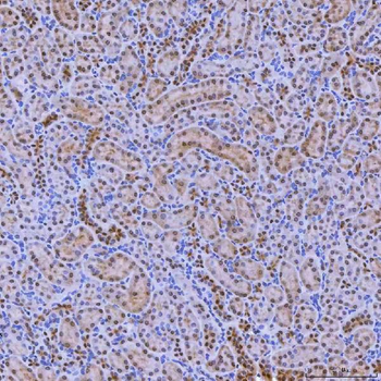 SNRNP200 Antibody