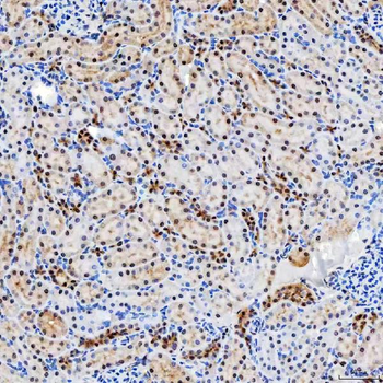 SNRNP200 Antibody