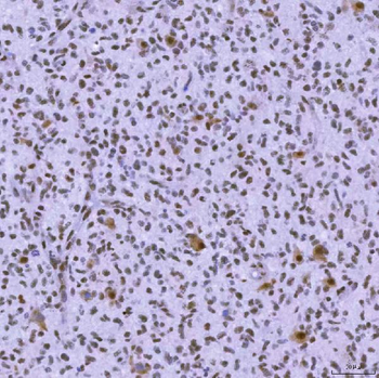 SNRNP200 Antibody