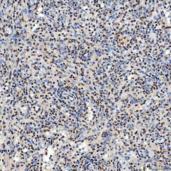 SNRNP40 Antibody