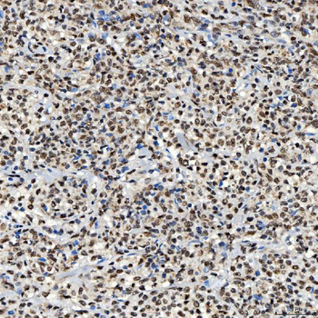 SNRNP40 Antibody