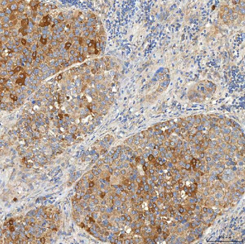 SNPH Rabbit Polyclonal Antibody