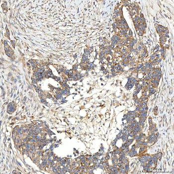 SNPH Rabbit Polyclonal Antibody