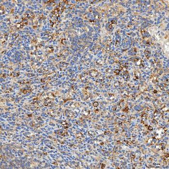 SNPH Rabbit Polyclonal Antibody