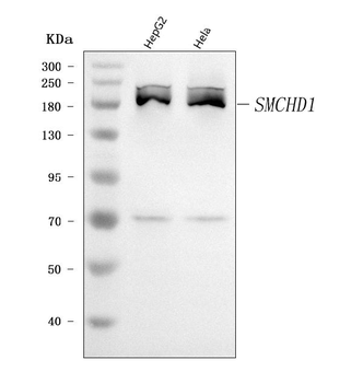 SMCHD1 Rabbit Polyclonal Antibody