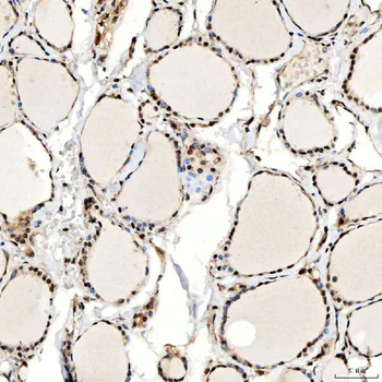 SNF2H/SMARCA5 Antibody