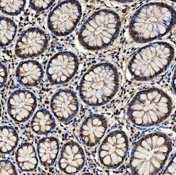 SNF2H/SMARCA5 Antibody