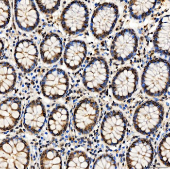 SMARCA2/BRM Antibody