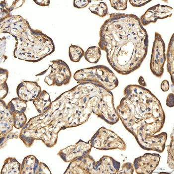 Citrin/SLC25A13 Antibody