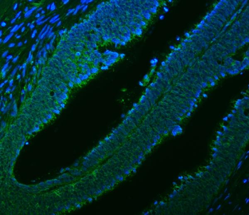 Citrin/SLC25A13 Antibody