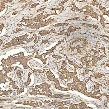 Citrin/SLC25A13 Antibody