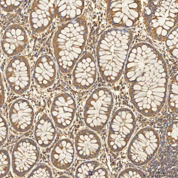 Citrin/SLC25A13 Antibody