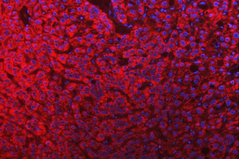 Mitochondrial dicarboxylate carrier/SLC25A10 Antibody