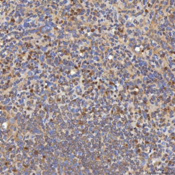 Mitochondrial dicarboxylate carrier/SLC25A10 Antibody