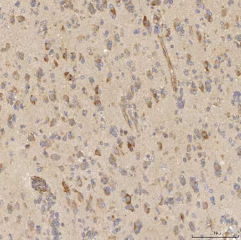 Mitochondrial dicarboxylate carrier/SLC25A10 Antibody