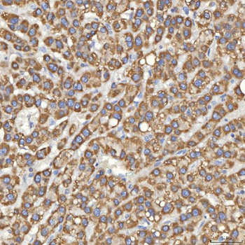 Mitochondrial dicarboxylate carrier/SLC25A10 Antibody