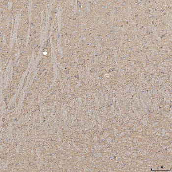 SLC20A1 Antibody