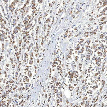 SLC20A1 Antibody