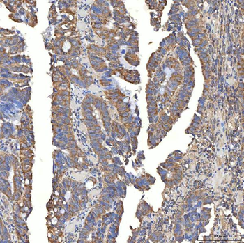SLC20A1 Antibody