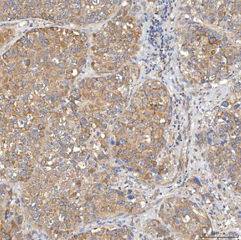 SLC20A1 Antibody