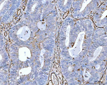 CD105/ENG Rabbit Polyclonal Antibody