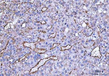 CD105/ENG Rabbit Polyclonal Antibody
