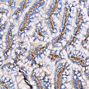 col6a2 Rabbit Polyclonal Antibody