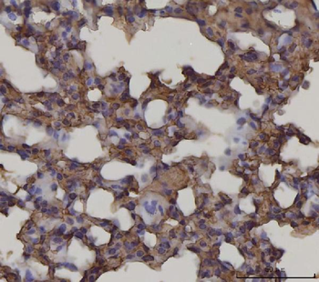 RAGE/AGER Mouse Monoclonal Antibody