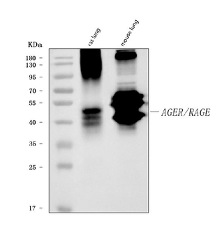 RAGE/AGER Mouse Monoclonal Antibody