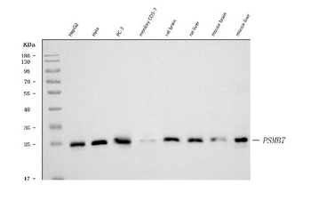 Proteasome 20S beta 7/PSMB7 Mouse Monoclonal Antibody