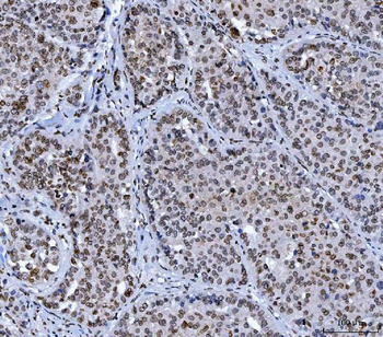 Lamin A+C/LMNA Antibody (monoclonal, 5F3C12)
