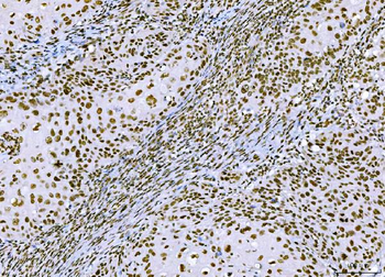 CTBP2 Antibody (monoclonal, 7F3E1)