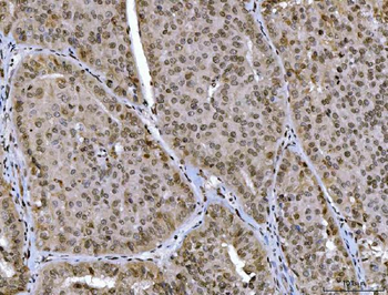 CTBP2 Antibody (monoclonal, 7F3E1)
