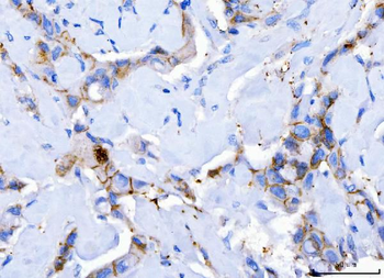 Desmoglein 2/DSG2 Mouse Monoclonal Antibody